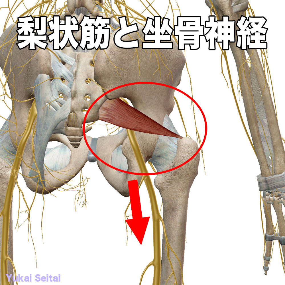 梨状筋と坐骨神経の位置関係