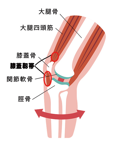 膝痛の原因の一つ膝蓋腱炎
