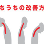 首の痛み
