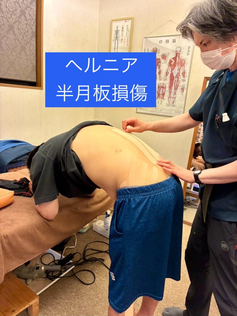 腰と左膝の症状で来院した48歳男性への施術の様子