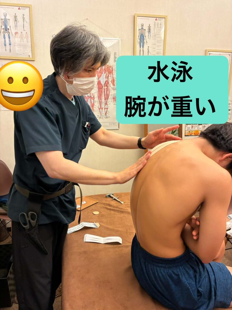 水泳で腕が上げにくい中学生の肩周辺を確認後テーピングしている様子